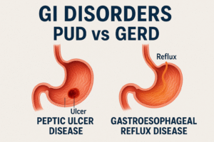GI Disorders Part 1 of 4. GERD vs PUD