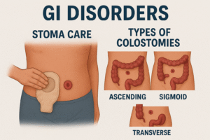 stoma care and types of colostomies